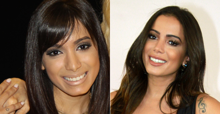 antes-e-depois-medico