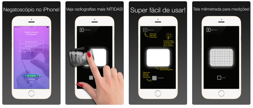 app-para-dentista-para-enxergar-radiografia-negatoscope