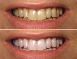 Marketing para Dentistas