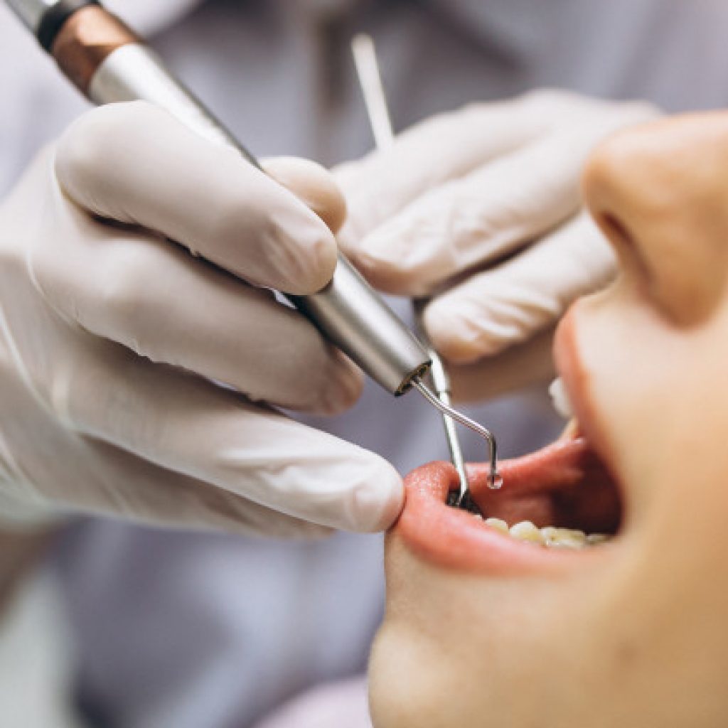 7 ferramentas de dentista que são essenciais para qualquer clínica odontológica