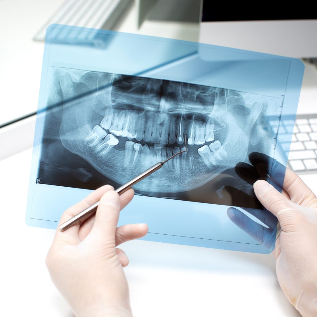5 dicas de Marketing para clínicas de radiologia odontológica